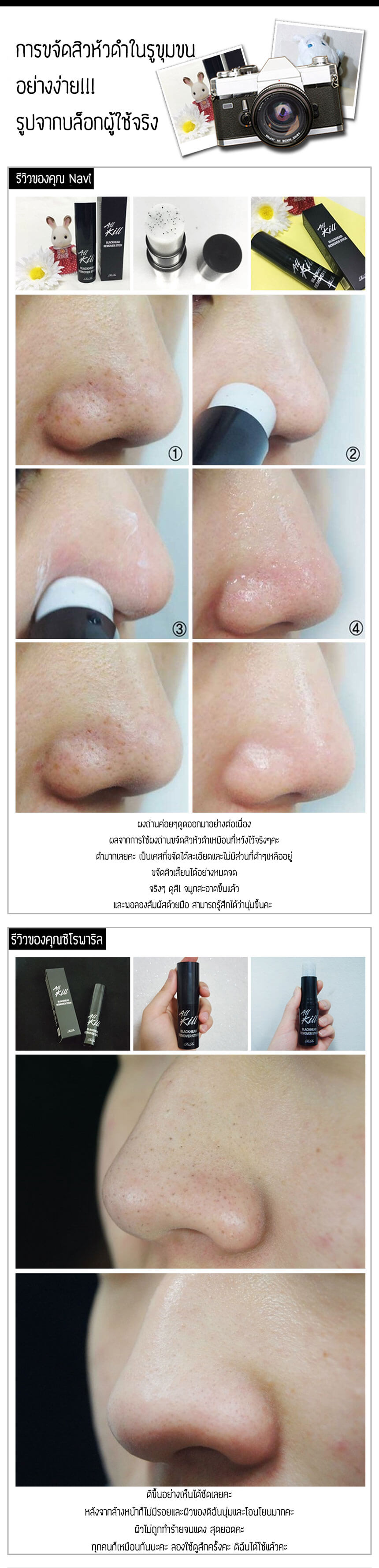 Rire,All Blackhead Remover Stick,กำจัดสิวเสี้ยน,สิวหัวดำ